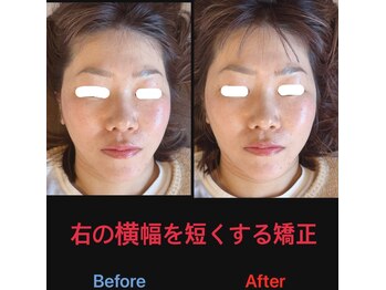 美容矯正サロン レレポノ(LELEPONO)/