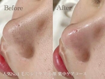 シャンディール(Shandeel)