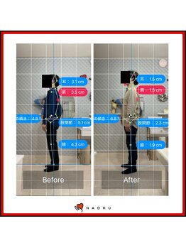 ナオル整体 錦糸町院(NAORU整体)/AI姿勢診断（横向き）