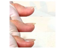 マタハライズネイル(MATAHARISE NAIL)の雰囲気（折れてしまったり、そり爪・深爪・お悩み爪も見違える仕上がりに）
