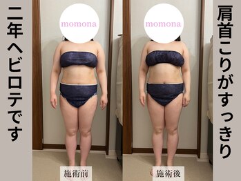 モモナ(Momona)/#肩こり#リンパマッサージ#野並