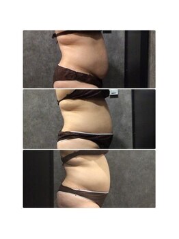 フローボディ 新山口店(flow BODY)/山口のエステはflow BODY