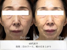 アストリエ グレース 相模大野(Astorie Grace)/1回でもリフトアップ♪