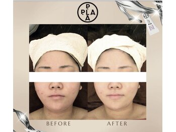 エミア(Emia)/韓国発☆プラチナ・プラピール