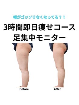 ホワイトビューティーラボ(White Beauty Lab)/3時間即日痩せコース足施術事例
