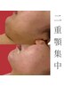 【V字小顔矯正コース】二重あご撲滅！圧倒的変化！今までで一番小顔に