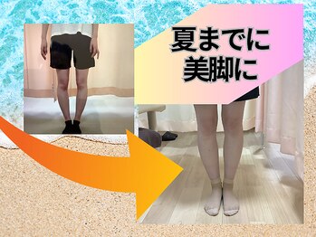 ぐっすり整体 福岡天神院の写真/本気で改善したい方限定！実は多いO脚・X脚の根本改善は”ぐっすり整体”にお任せください！
