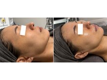 シミケア＆小顔専門サロン　ルアン～月艶～の雰囲気（シミもリフトアップも得意です。お任せ下さい♪【シミ/小顔/柏】）