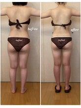 アンフィニ(infini)/短期集中コース6回目（2カ月）