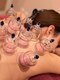 美と健康と痩身サロン マリアローズ(Maria Rose)の写真/もみほぐしでは物足りない頑固な首肩こりに◎人気のカッピングで血流促進！体の内側から綺麗にデトックス♪