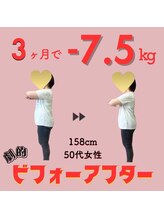 宮脇施術院/50代女性ビフォーアフター