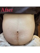 ウーマンビーヘルス(woman Be Health)/妊娠中の方　お腹の形　施術後