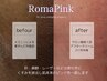 《黒ずみをピンクへ!最新美容術 Roma Pink 》ローマピンク無料カウンセリング