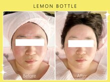 ハノハノ 八代店(HANO HANO)/【八代初導入！】レモンボトル☆