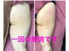 食事制限しても痩せません!痩身カウンセリング+ハイパーナイフ1パーツ¥6980