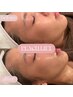 【韓国最新小顔】ピーチリフト(全顔＋首）＋お悩み別モデリングマスク