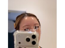 トワエクレ(toi e'clat)の雰囲気(プラピール・グロスピールで水光肌に☆すっぴんでも自信ある肌へ)