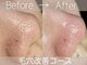 リム(Lim)の写真