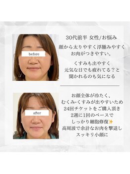 メディカルエステ 東銀座店/30代前半 女性