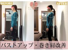 ヴィオーデ 船橋店/小顔、リンパ、ヘッドスパ、骨盤