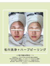 ソワナ(soina)/【神楽坂駅/フェイシャル/毛穴】