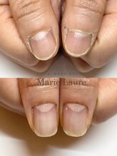 マリーロール 淀屋橋本店(Marie Laure)/深爪矯正/自爪育成/ネイルケア