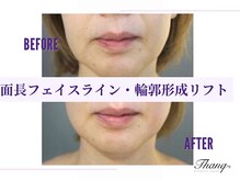 サンク(Thanq)/もたつく輪郭シャープなラインへ