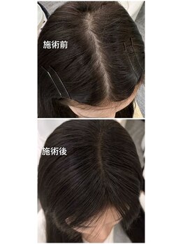 ワンダー(WONDER)/お問い合わせもできます。