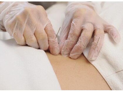 すがはら鍼灸院の写真