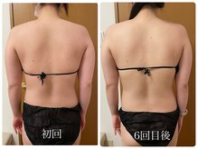 ムム(MooMoo)/背中＋二の腕引き締め6回