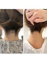 ミース 宇都宮店/うなじ矯正◆ビフォーアフター