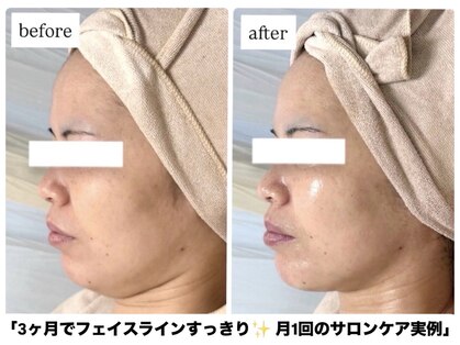 エムイーボーテ(me.Beaute)の写真