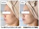 エムイーボーテ(me.Beaute)の写真