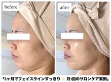 エムイーボーテ(me.Beaute)