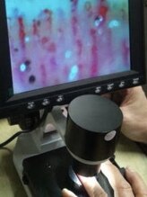 いつつのき/血流・毛細血管チェック