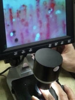 いつつのき/血流・毛細血管チェック