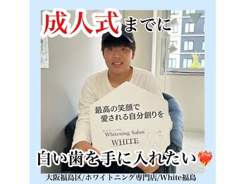 ホワイトニングサロン ホワイト(WHITE)/セルフホワイトニング/大阪/福島