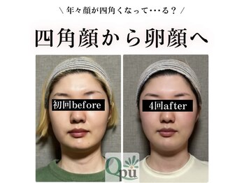 キュープ 鹿児島伊集院店(Qpu)/骨格のせいじゃないかも？