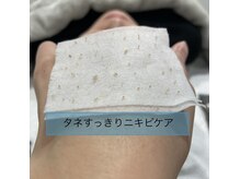 スキン ラボ ケー(Skin lab K)