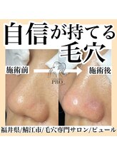 ピュール 鯖江店(PUR)/毛穴サロン/毛穴ケア/毛穴洗浄