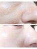 【水光肌美白】プラズマ美白xWhite Shine Mask ¥14,000→¥9,300