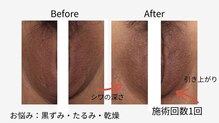 ベニート 銀座(BENITO)