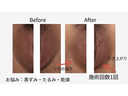 ベニート 銀座(BENITO)の写真