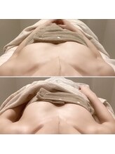 オレオール(aureole)/バストアップケア