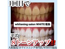 ホワイトニングサロン ホワイト(WHITE)/セルフホワイトニング/大阪/福島