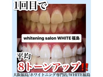 ホワイトニングサロン ホワイト(WHITE)/セルフホワイトニング/大阪/福島