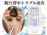 背中ニキビケア/毛穴/ザラつきに背中ハイドロピーリング【背中全体】¥10340→
