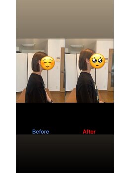 ヴィバランス(Vebalance)/ストレートネック矯正