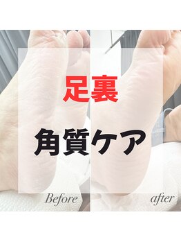 KIREI SHARE by princess rose マツエク/まつげパーマ/眉毛/メンズ/脱毛/フェイシャル/