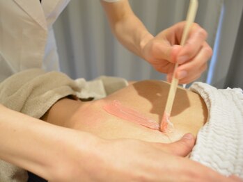 ビジュー(bijou)/ワックス脱毛